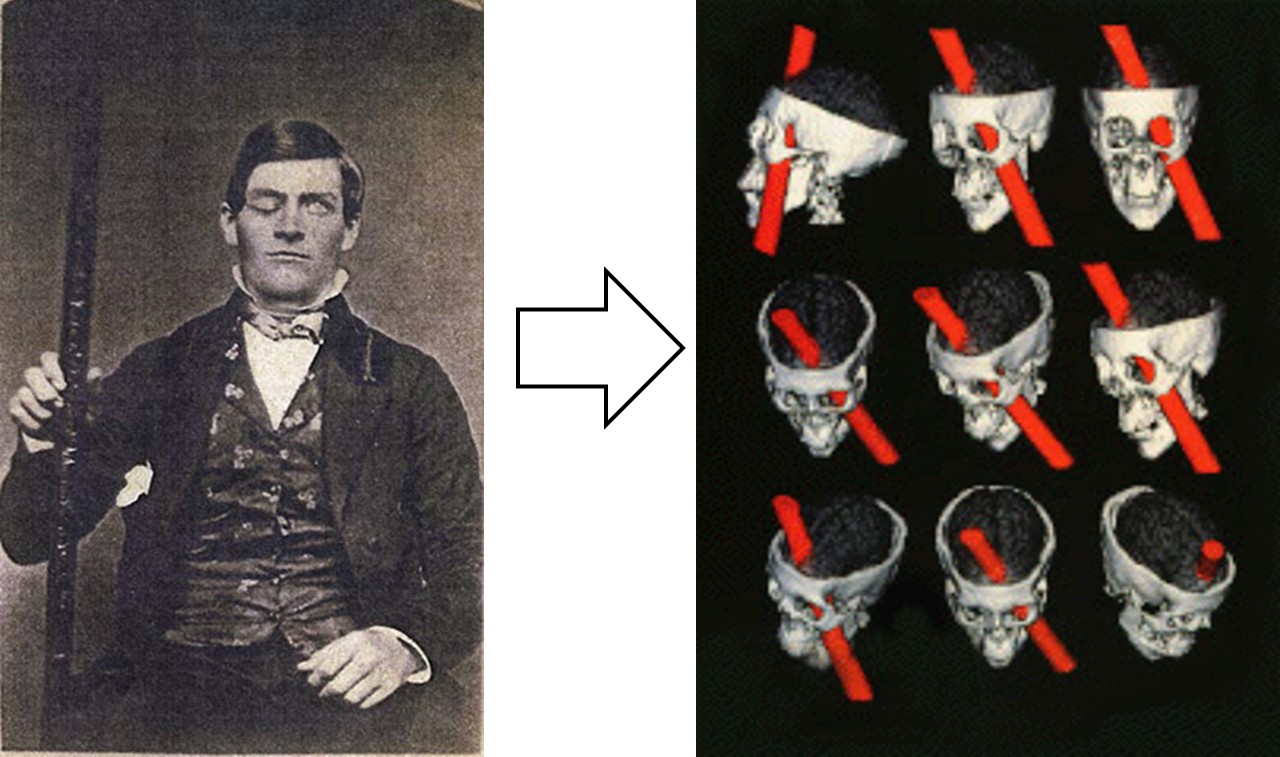Phineas Gage